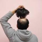Are Hair Patches Truly Comfortable To Wear? Let’s Find out