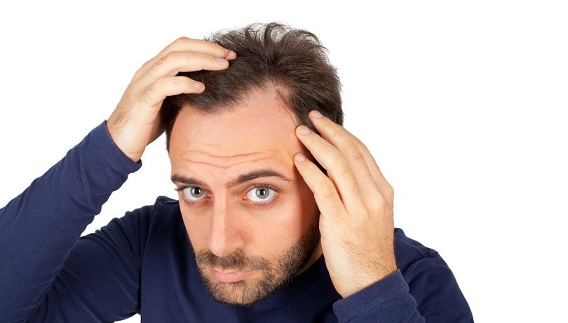 Hair Patches for Men in Dubai