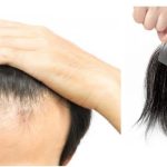 Top Trends in Men’s Hair Fashion: Why Hair Patches Are Gaining Popularity