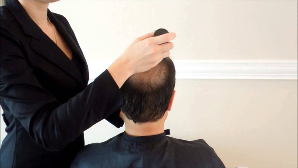 Hair Patches and Toppers in Dubai