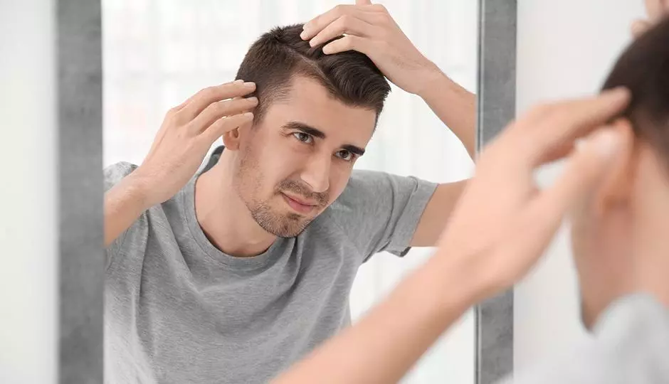 Identifying Hair Loss in Men