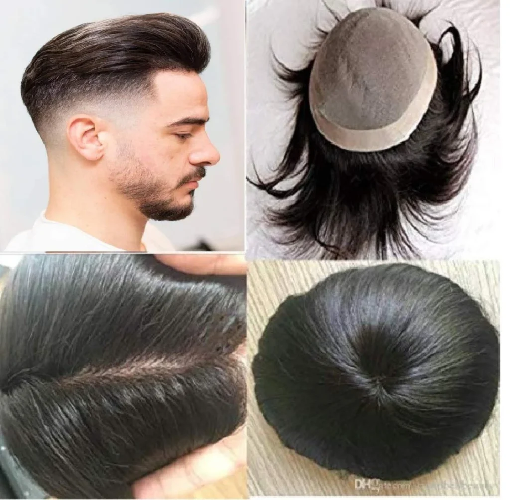 Hair Patch at HeyFix Dubai