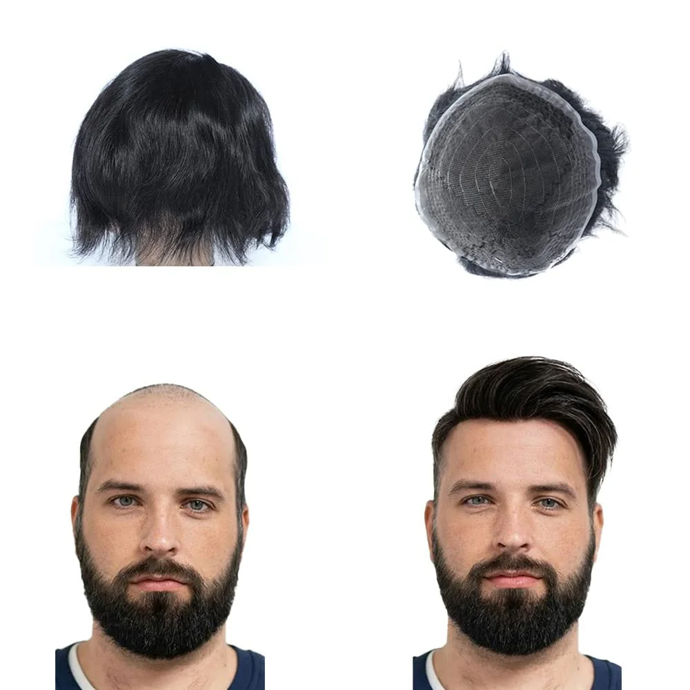 Hair Patch