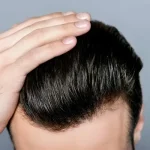 Hair Patch Styling Ideas in Dubai That Match Your Face Shape