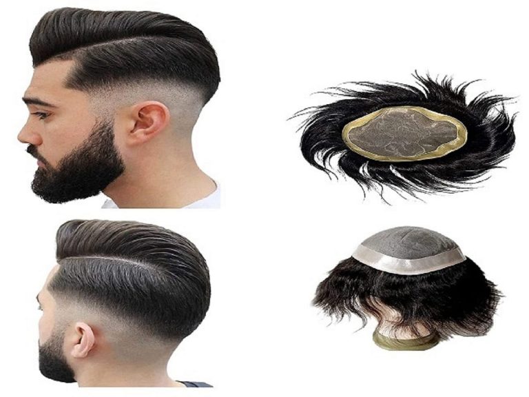How Hair Patches Keep Men in Dubai Looking Sharp All Day