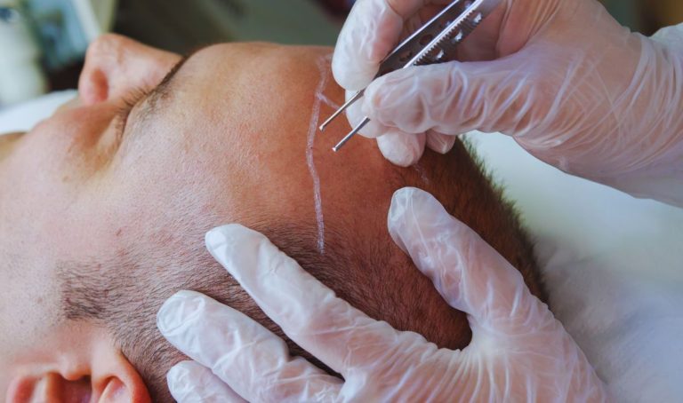 From 30 Minutes to a New You: Inside the Heyfix Transformation Experience