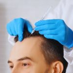 Is a Hair Patch Safe? What Dermatologists Say in 2026